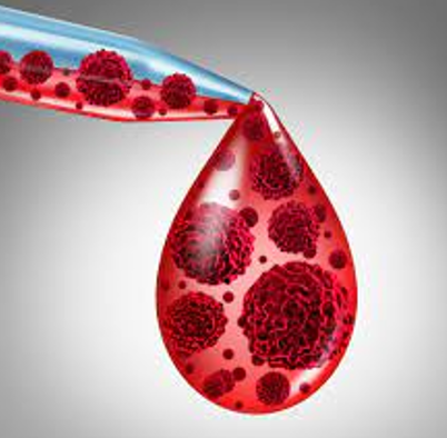 سازمان غذا و دارو آمریکا عنوان Fast Track و RMAT را به درمان CAR T cell آلوژنیک برای B-NHL اعطا می‌کند.